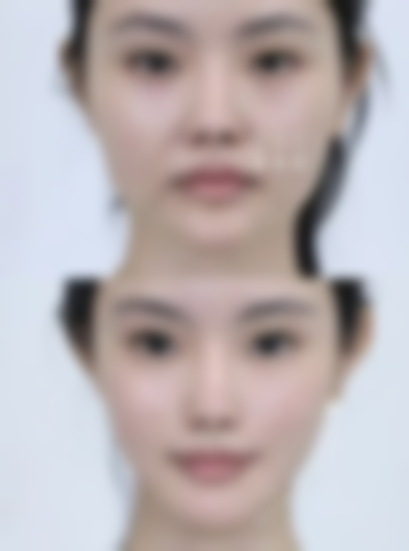 十堰淑美整形医院怎么样医生团队实力