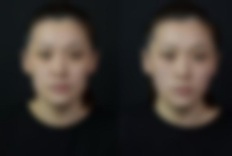 新疆高丽汉白医疗整形美容医院价格收费