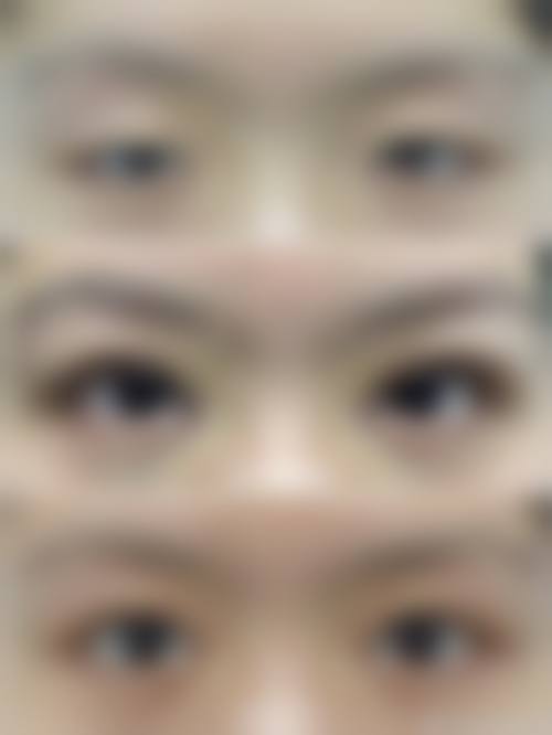 朱文煌医生的专精技术优势