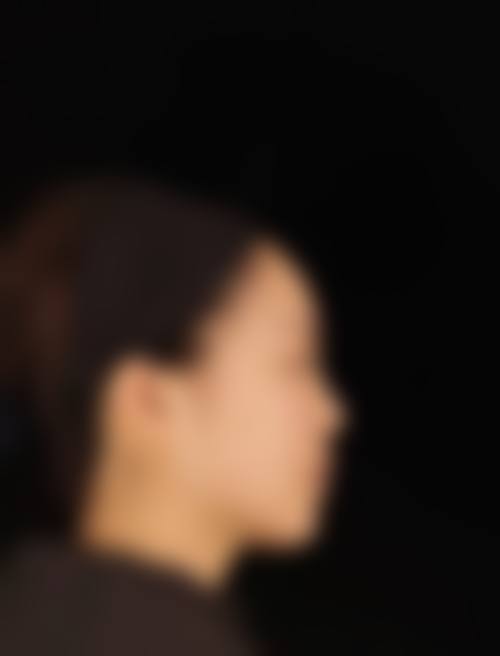 贵阳美吉拉（金馨）医疗美容门诊部价格收费