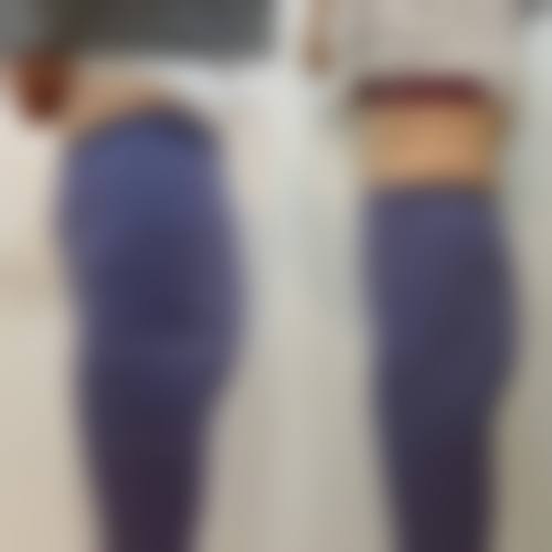 祝顺武医生的特色技术