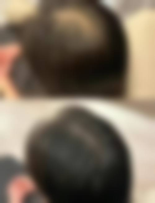 上海大麦植发医疗美容门诊部怎么样特色项目及技术优势