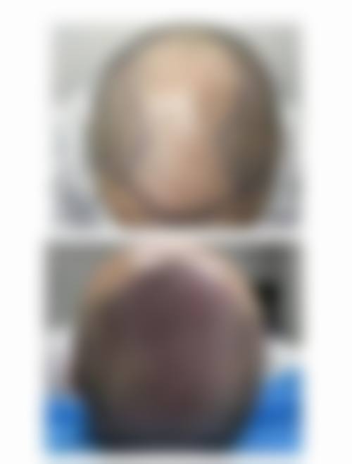 上海大麦植发医疗美容门诊部怎么样简介概述