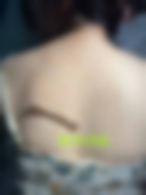 秦良忠医生的技术优势