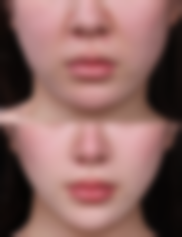 武汉肽慕医疗美容门诊部怎么样求美者反馈