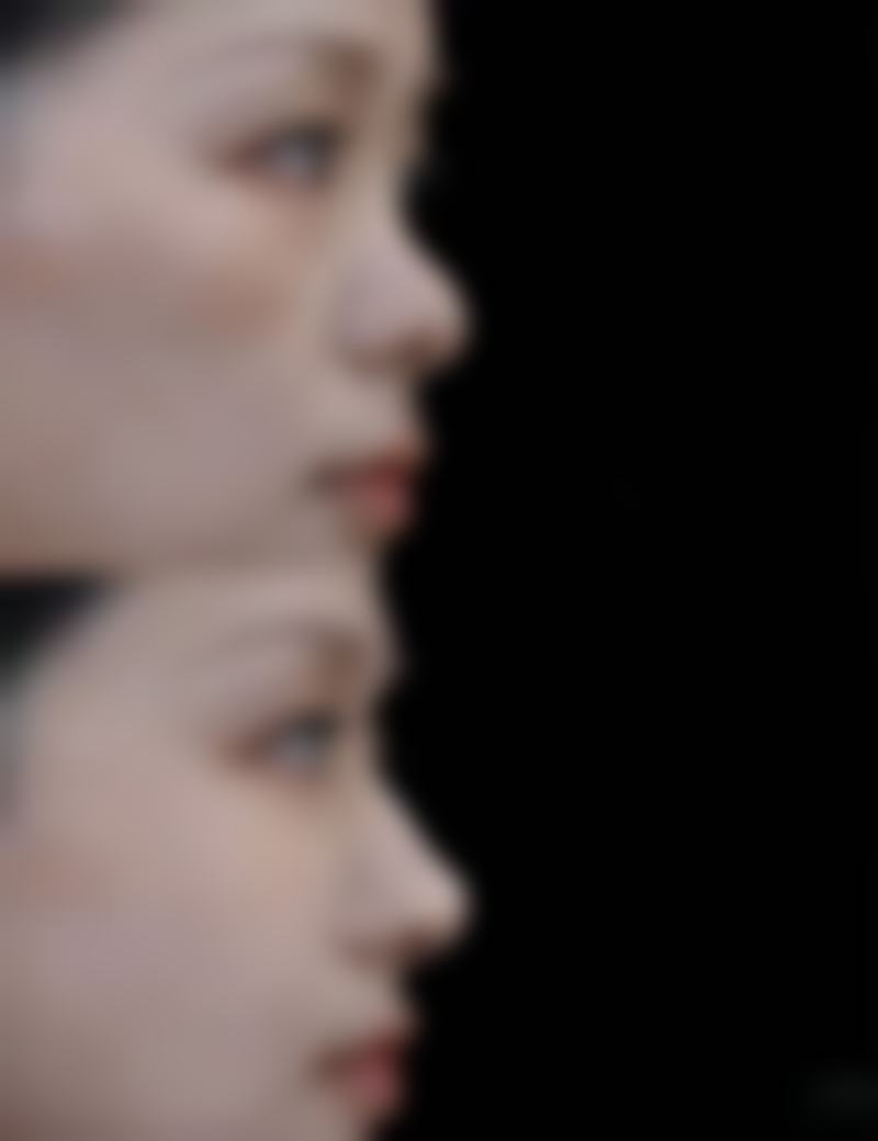 昆明拉雅医疗美容医院价格收费