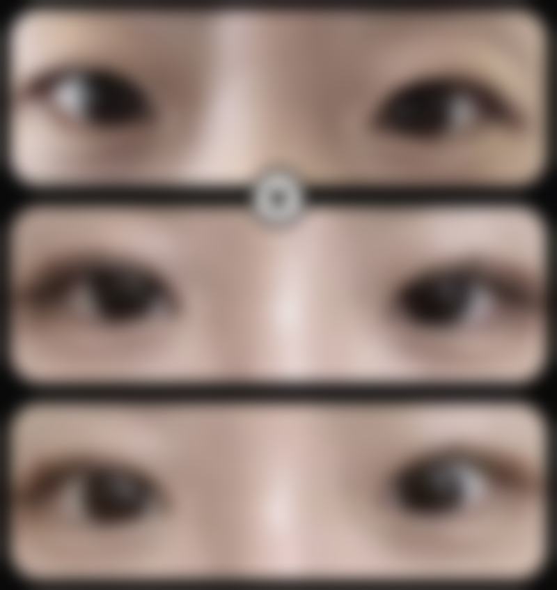 朱文煌医生的成功实例见证