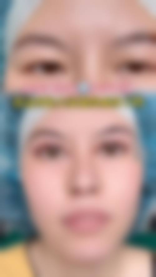 朱文煌医生坐诊科室：依托正规医院的专精医美平台