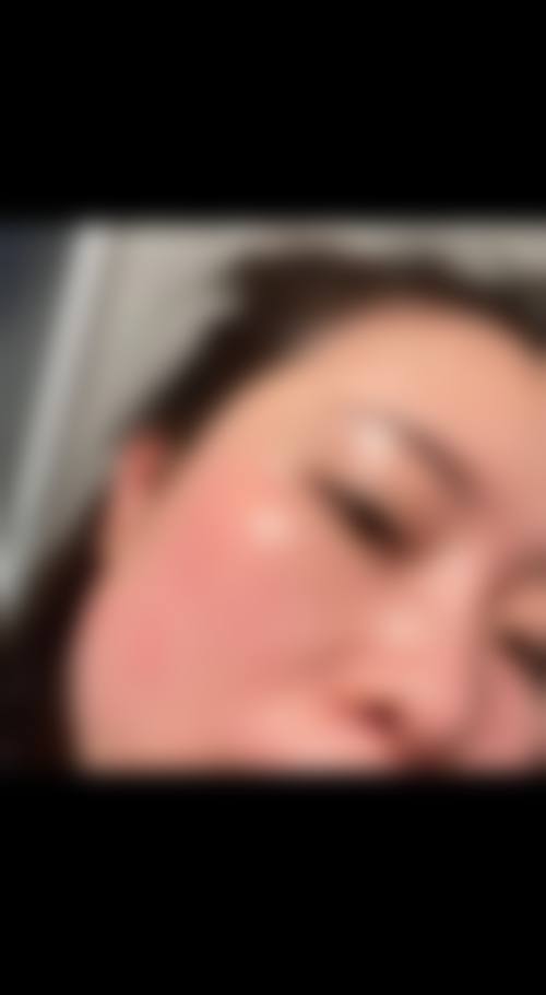 绍兴上虞市皮肤病防治医院整形科求美者反馈