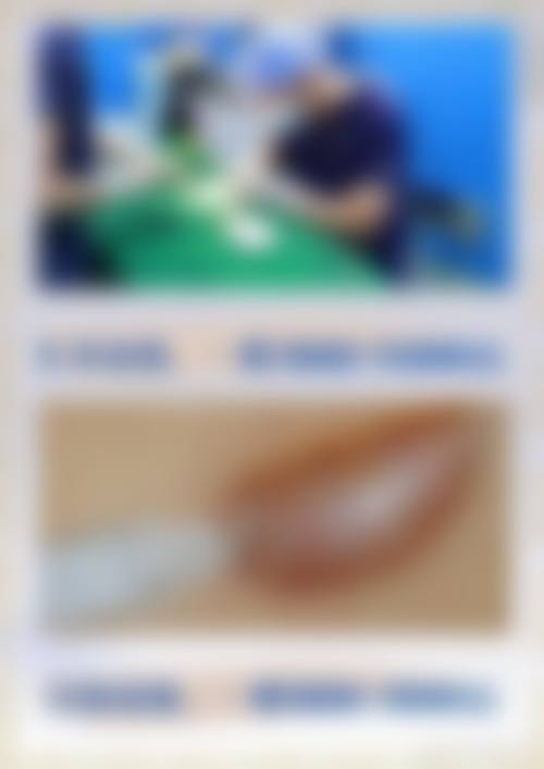 年京京擅长的特色医美项目，精细匹配个体需求