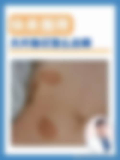 绍兴上虞市皮肤病防治医院整形科医生团队实力