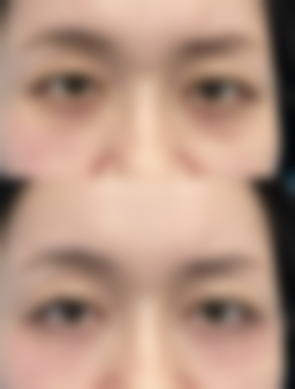 郑州有美医疗美容医院求美者反馈