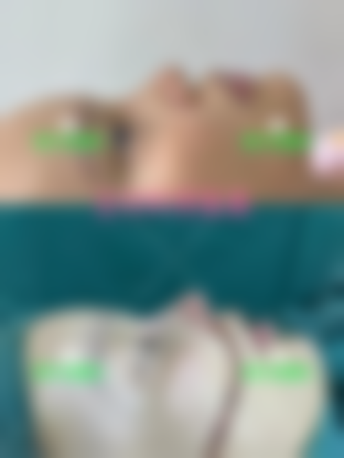 林飞鸿医生：安心可靠的医美操作标准