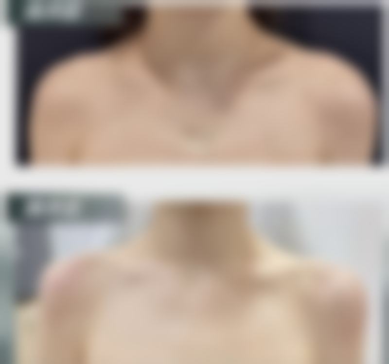 杨宏刚医生：依托院内精良设备的标准化诊疗体系