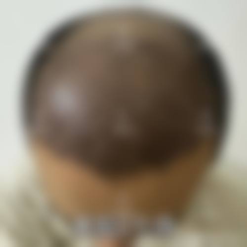 淮安高第植发来院路线