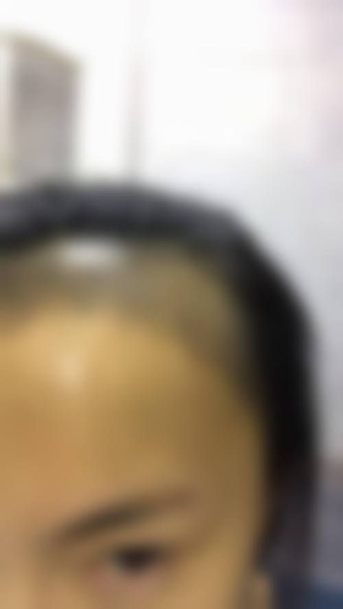 淮安高第植发价格收费