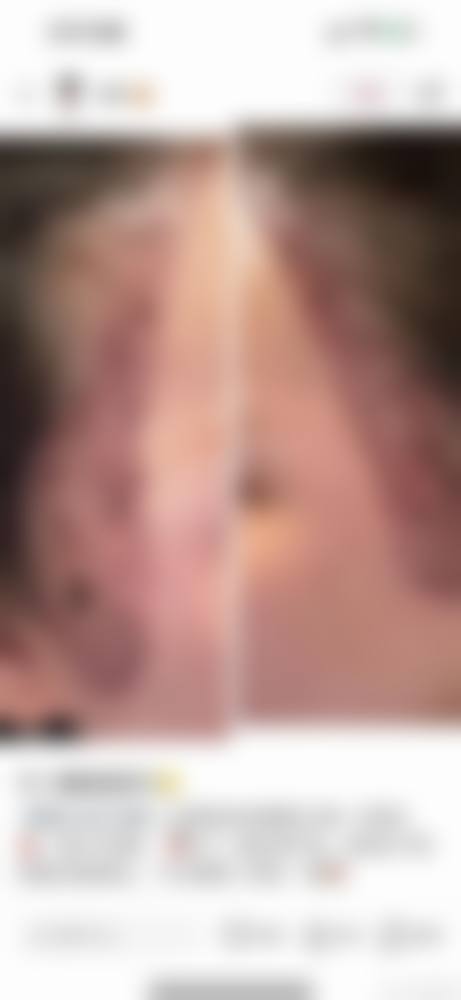 淮安高第植发医生团队实力