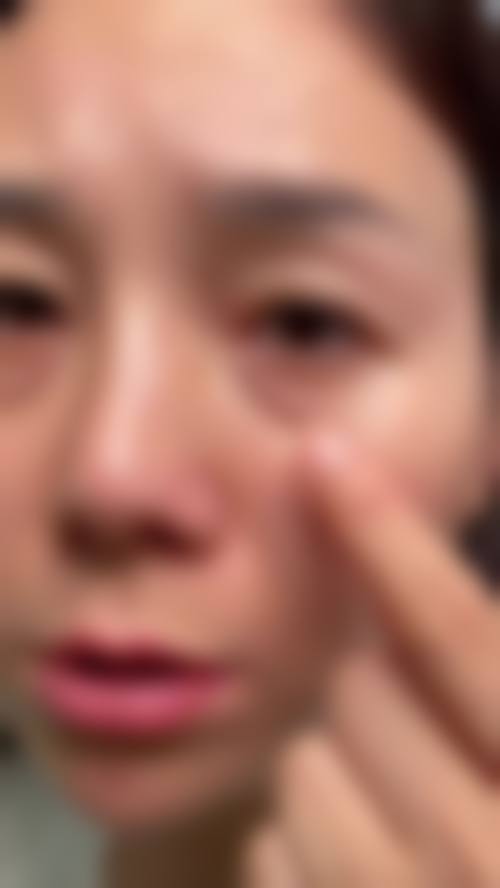 赖东兰医生依托南昌韩美精尖医美环境开展诊疗