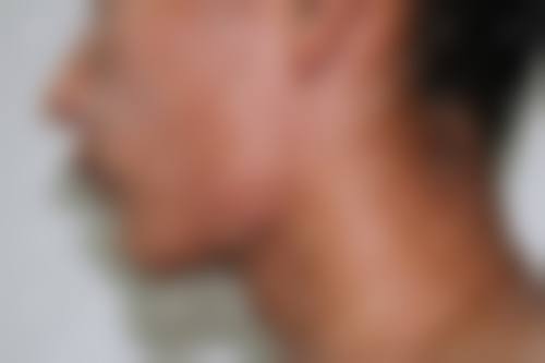 合肥丛生医疗美容门诊怎么样来院路线