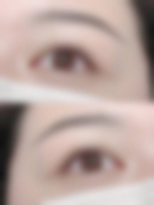 张永光医生：坚持个性化定制的诊疗原则