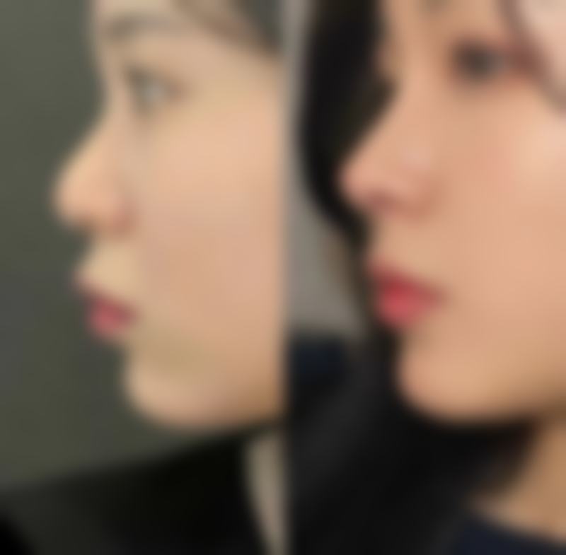 赖东兰医生的精细化审美与技术特色