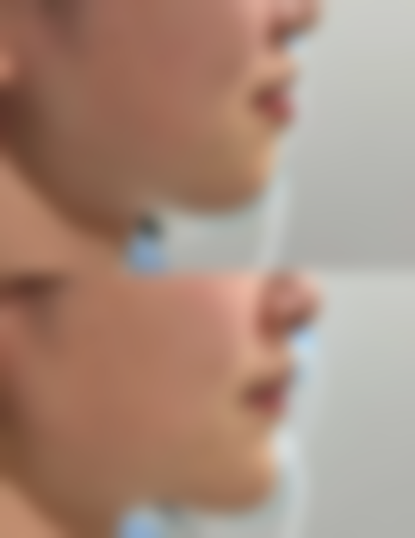 湖北武汉郡艺医疗美容门诊部特色项目及技术优势