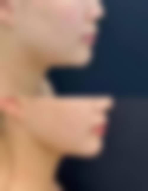 韩国狎鸥亭STORY整形外科医院价格收费