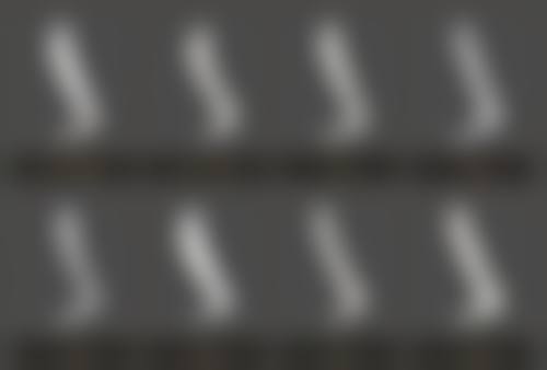 呼和浩特五维医疗整形美容医院求美者反馈