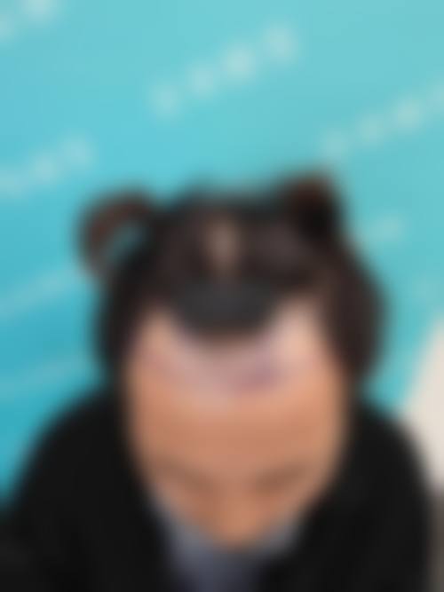 毛杰琳整形外科求美者反馈