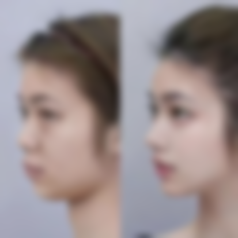 韩国狎鸥亭STORY整形外科医院特色项目及技术优势