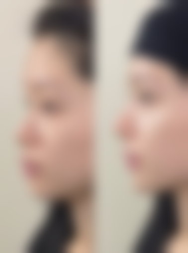 沈阳金皇后整形美容医院求美者反馈