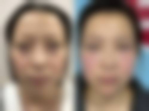 祝顺武融合中韩审美，打造贴合东方人的自然美感