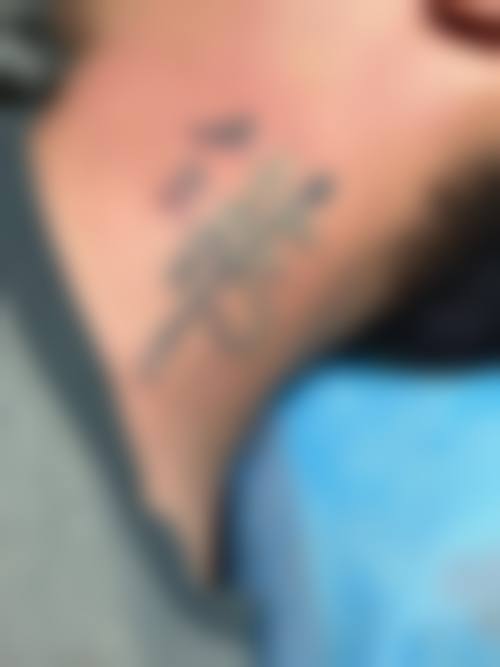 甄永环医生可开展的特色医美技术