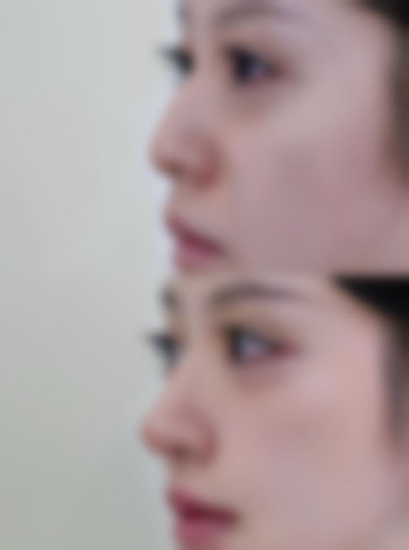 常州激光专科医院整形美容中 心特色项目及技术优势