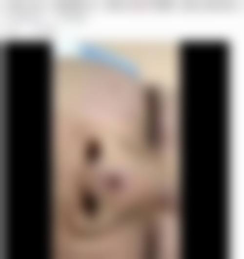 杨博主推的特色医美技术