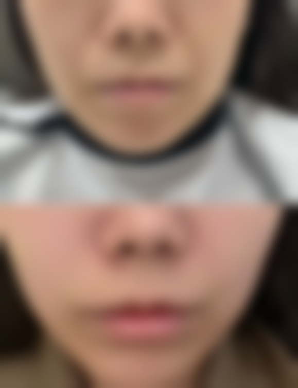 张赫医生可借助的精良医美技术