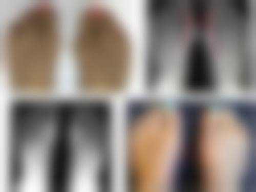 凉山会理廖氏牙科诊所价格收费