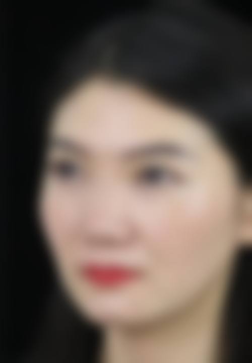 张永光医生依托的专精诊疗保护