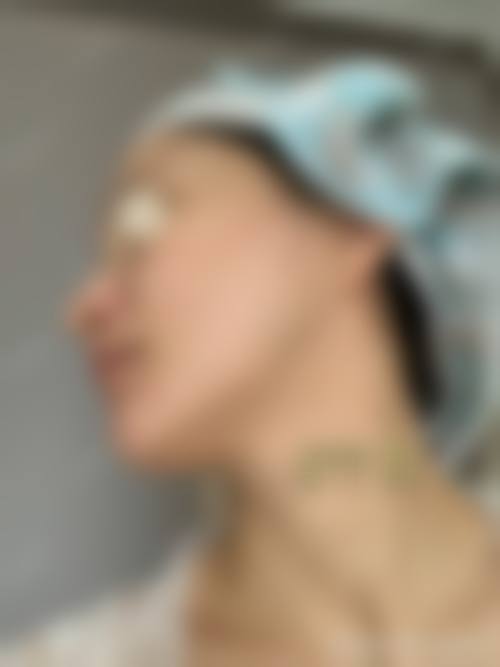 荆州阿芙罗整形医疗美容门诊部求美者反馈