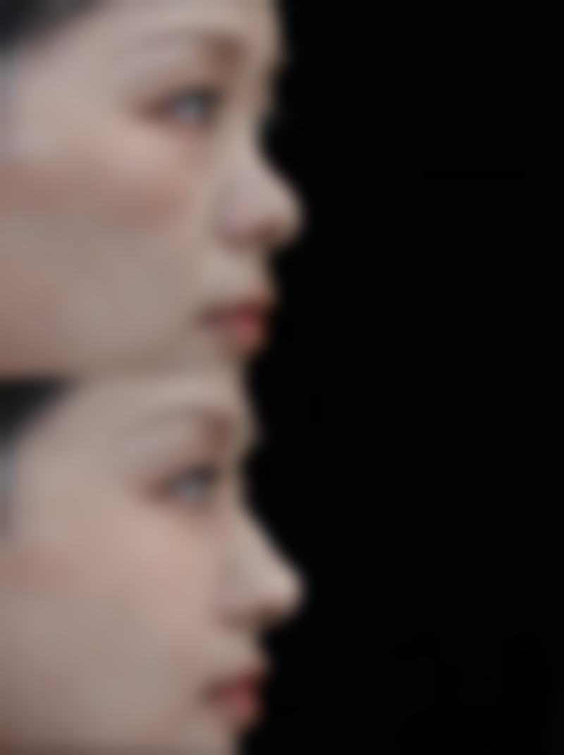 宜春甜橙国内外整形医院价格收费