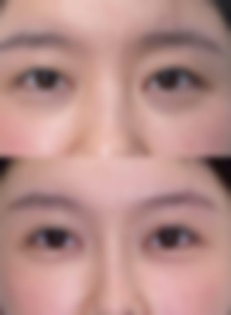 赖东兰医生：坚持个性化定制，拒绝同质化医美