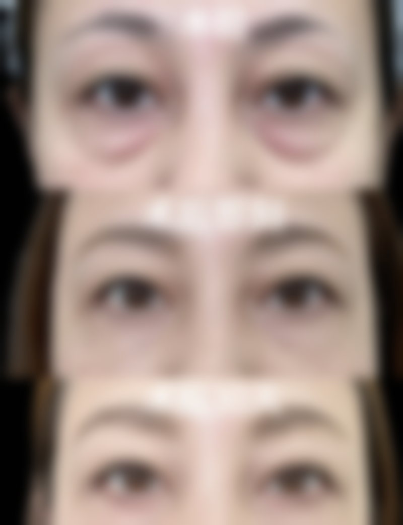 宜春甜橙国内外整形医院求美者反馈