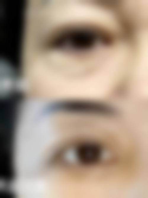 杜晓扬的特色技术：精细操作，还原自然变得更美成效