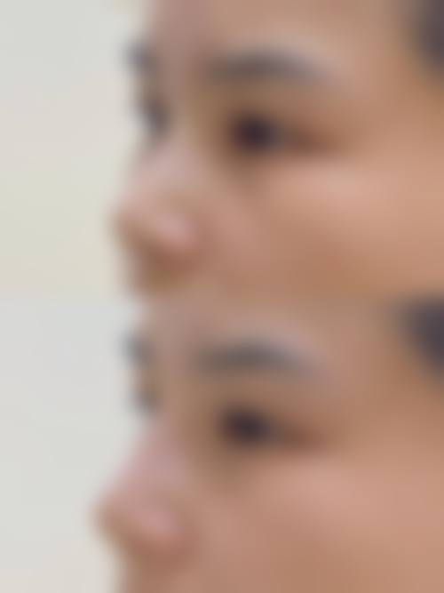 重庆妮杨丝整形医院价格收费