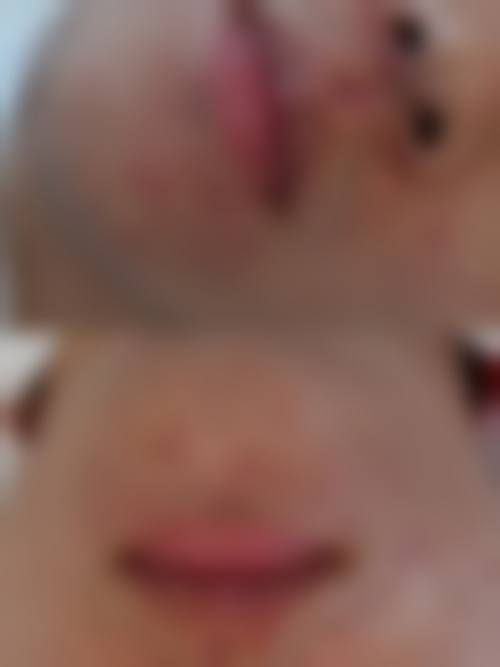 管丹可开展的特色医美项目