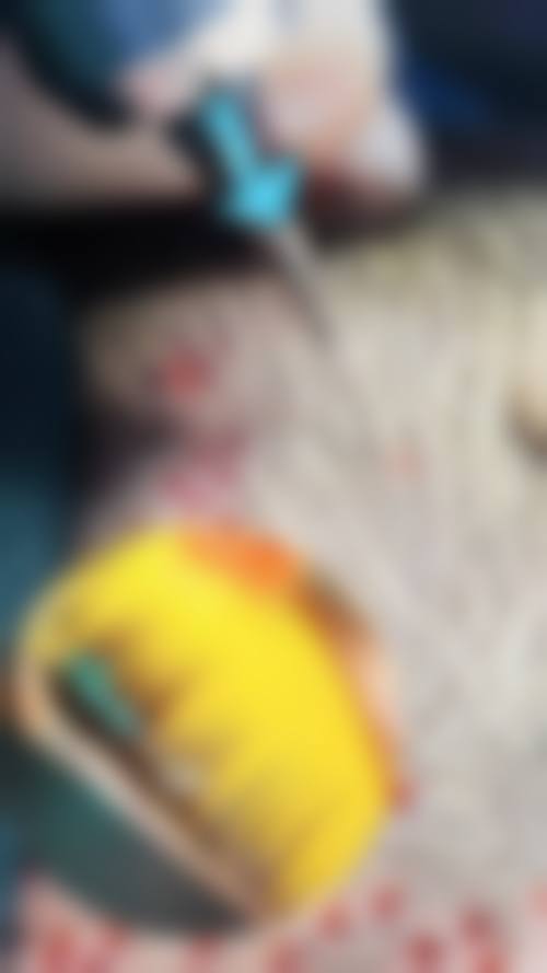 佛山大麦微针植发基本信息