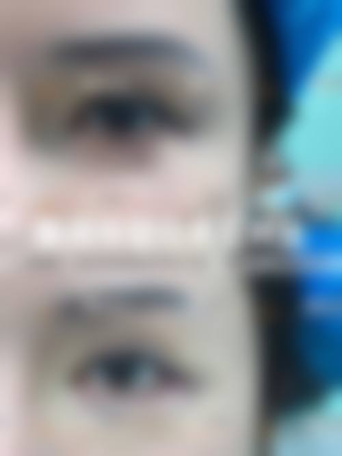 长治悦美整形求美者反馈