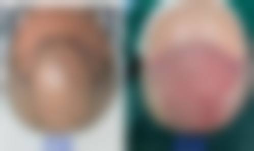 皮超医生覆盖的全品类诊疗与美容项目