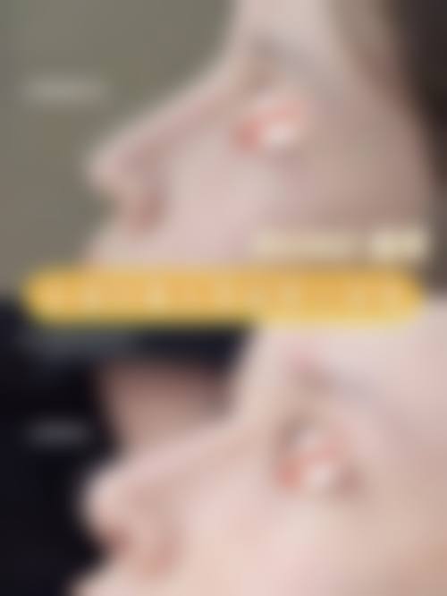 石家庄美然医疗美容门诊部价格收费