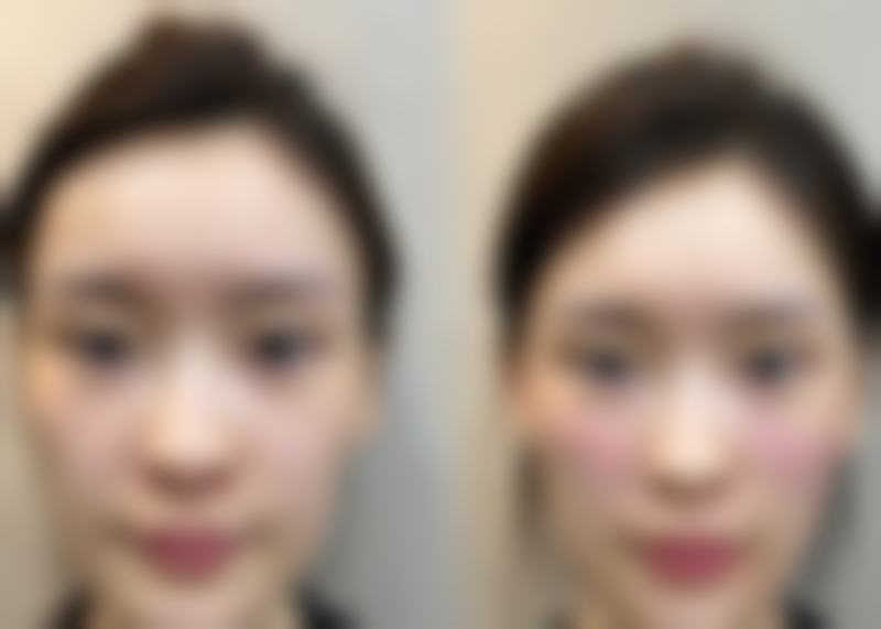 桐乡甄美龄整形医院来院路线